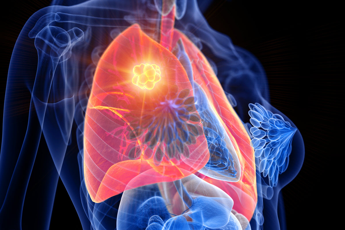 VI Simposio ICAPEM 2022