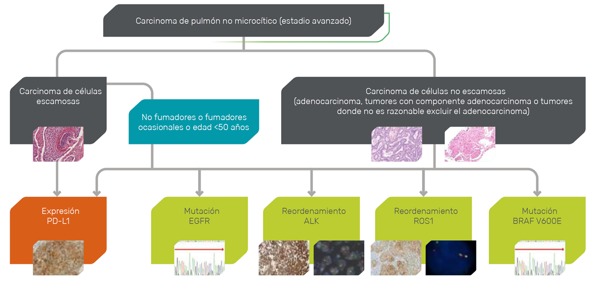 Diagnostic algorithm for determining biomarkers in advanced NSCLC patients